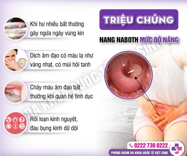 Nang naboth cổ tử cung và những điều chị em cần biết