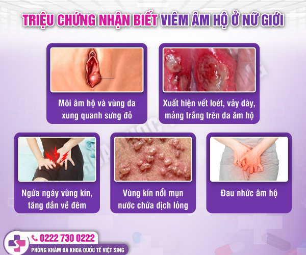 Những lầm tưởng tai hại về viêm âm hộ mà chị em cần làm rõ!